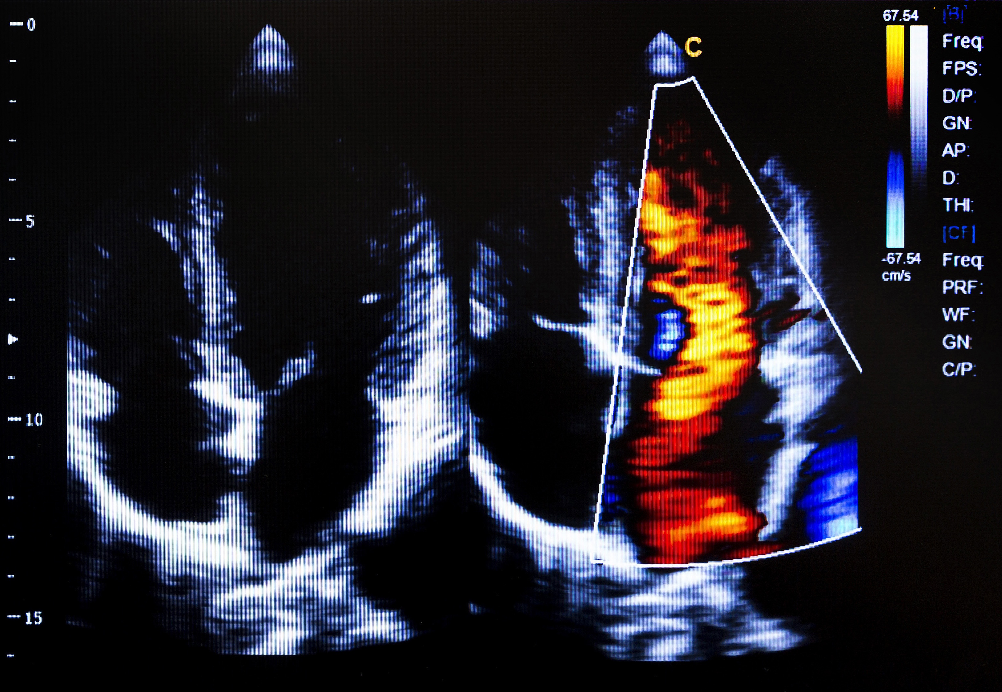 Telecardiology: Using Off-Site Cardiologists to Interpret Cardiac Imaging Studies