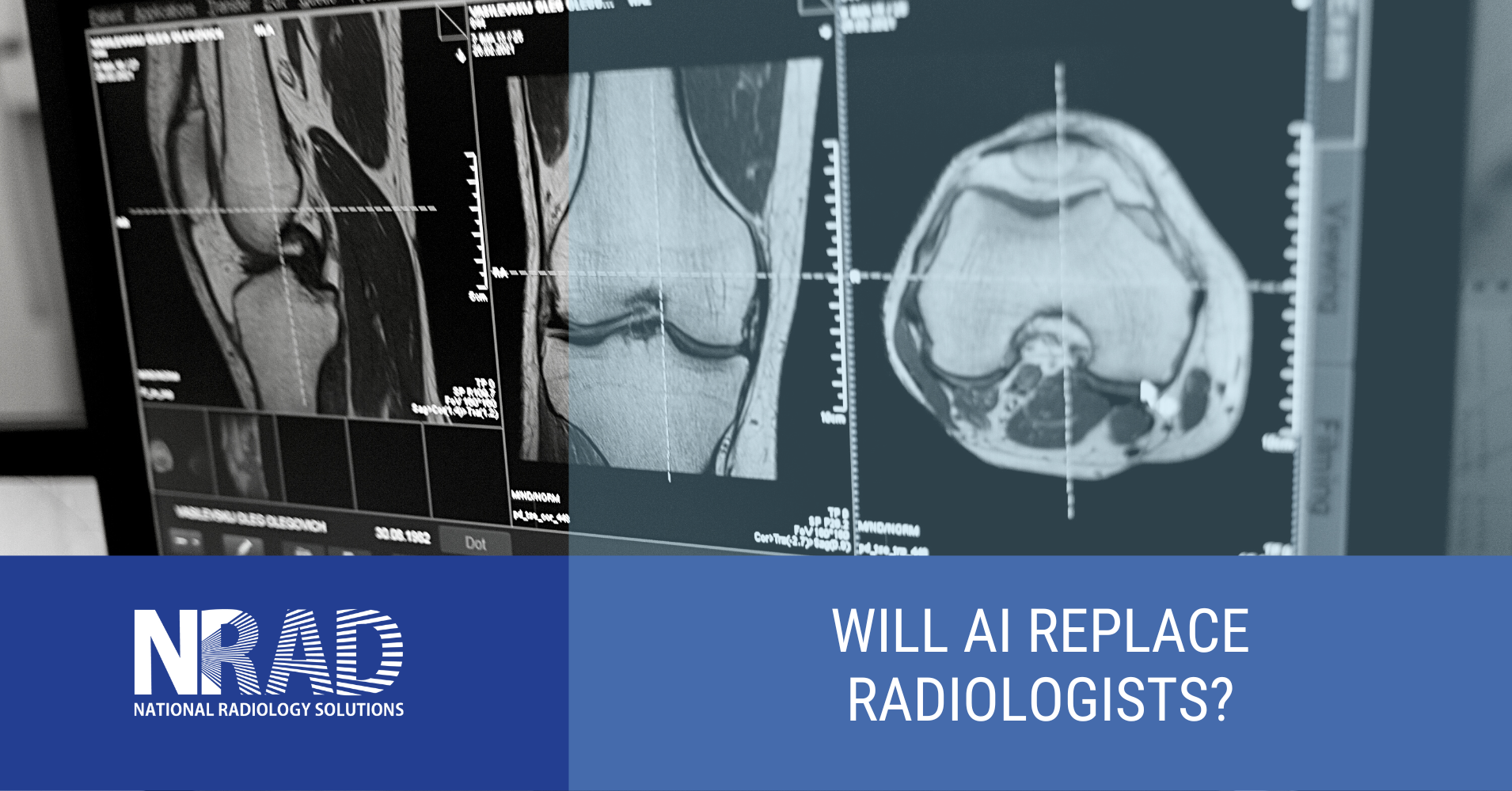 Will AI Replace Radiologists?